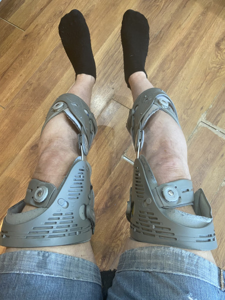 A person wearing black socks and denim shorts has both legs in medical braces while seated. The braces are grey with metal hinges and straps, and the background features a wooden floor.